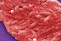 Bacterial Diseases in Humans
