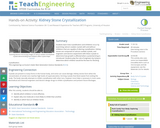 Kidney Stone Crystallization