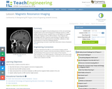 Magnetic Resonance Imaging