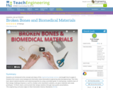 Broken Bones & Biomedical Materials