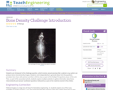 Bone Density Challenge Introduction