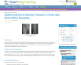 Exploring Bone Mineral Density