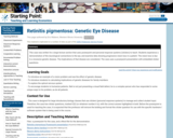 Retinitis pigmentosa: Genetic Eye Disease