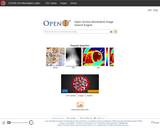 Open-i: Open Access Biomedical Image Search Engine