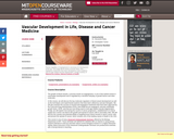 Vascular Development in Life, Disease and Cancer Medicine, Fall 2009