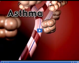 Healthy Circulatory and Respiratory Systems: Asthma