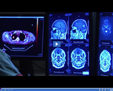 SciTech Now: TMS Treatment (Segment)