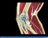 Healthy Skeletal and Muscular Systems: Cartilage II