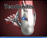 Healthy Skeletal and Muscular Systems: Tendonitis