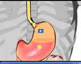 Nutrition Basics: Chyme