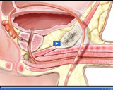 Reproduction and Development: Prostate