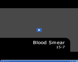 Medical Assisting. Blood Smear: 15-7.