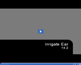 Medical Assisting. Irrigate Ear: 14-2.