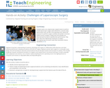 Challenges of Laparoscopic Surgery