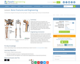 Bone Fractures and Engineering