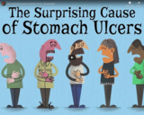 TED Ed - The surprising cause of stomach ulcers - Rusha Modi