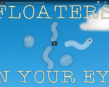 TED Ed - What are those floaty things in your eye? - Michael Mauser