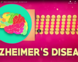 TED Ed - What is Alzheimer's disease? - Ivan Seah Yu Jun