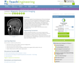 Magnetic Resonance Imaging