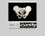 Forensics specimen male pelvis high-angle view