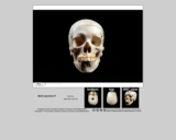 Forensics skull specimen P