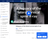 Adequacy of the Lateral Cervical Spine X-Ray