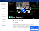 Diagnosing active TB