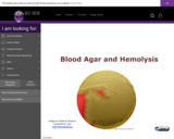 Wisc-Online Blood Agar and Hemolysis