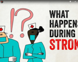 TED Ed - What happens during a stroke? - Vaibhav Goswami