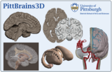 PittBrains3D: Digital 3D Models for Neuroanatomy Instruction