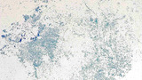 Micrograph Escherichia coli methylene blue 100x p000003