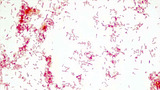 Micrograph Escherichia coli safranin red 1000x p000004
