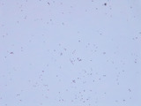 Micrograph Escherichia coli Gram stain 100x p000008