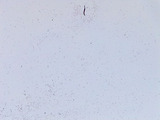 Micrograph Escherichia coli Gram stain 100x p000009