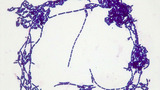 Micrograph Bacillus subtilis Gram stain 1000x p000010