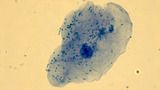 Micrograph human cheek epithelial cells methylene blue 1000X p000017