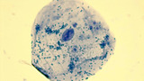 Micrograph human cheek epithelial cells methylene blue 1000X p000018