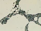 Micrograph Candida albicans Gram stain 100x p000021