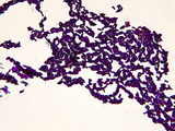 Micrograph Candida albicans Gram stain 400x p000022