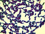 Micrograph Candida albicans Gram stain 1000x p000024