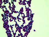 Micrograph Candida albicans Gram stain 1000x p000025