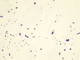 Micrograph Staphylococcus aureus Gram stain 1000x p000028