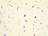 Micrograph Staphylococcus aureus Gram stain 1000x p000029