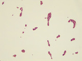 Micrograph Neisseria sicca Gram stain 1000x p000030
