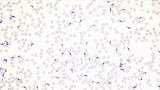 Micrograph Trypanosoma cruzi in blood smear giemsa 400x p000032