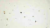 Micrograph Giardia fecal smear 400x p000034