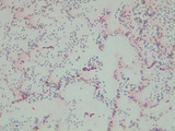 Micrograph Bacillus subtilis 5d endospore 1000X p000064