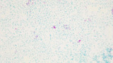 Micrograph Escherichia coli and Mycobacterium smegmatis acid fast 1000X p000070