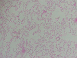 simple squamous epi_lung alveoli_100x, p000119