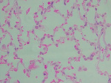 simple squamous epi_lung alveoli_400x, p000120